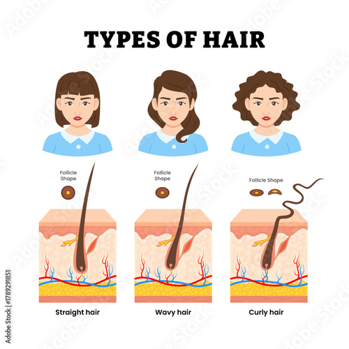 Different types of hair shape type. Labeled straight, wavy, curly hair follicle shape with woman or girl character. Different hair texture. Skin structure anatomy cross section. Vector illustration.