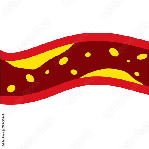 Medical Illustration of Cholesterol Buildup in Artery