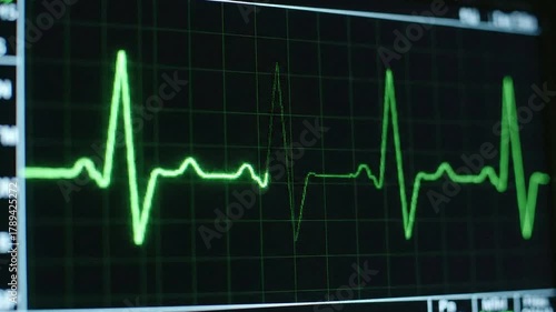 EKG Display Recording a Heartbeat with Fluorescent Green Lines Overlaid on a Black Screen in a Medical Setting Vital Signs Diagnostic Tool and Clinical Application