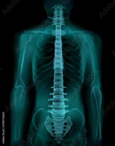 Medical x-ray scan of the human anatomy showing the chest, spine, and full skeleton