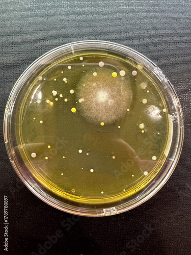 Multicolored colonies of microorganisms on a Petri dish, close-up.
