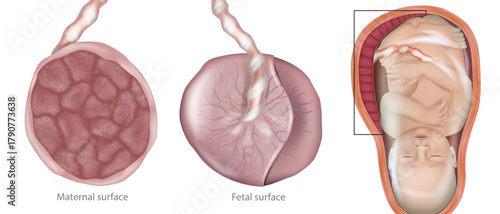 Medical illustration of the human placenta with both maternal and fetal surfaces, connected to the umbilical cord, and a fetus inside the uterus. Human placenta anatomy