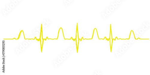 Vector illustration of an abstract medical heartbeat pulse line cardiogram graph on a monitor for healthcare and medicine technology