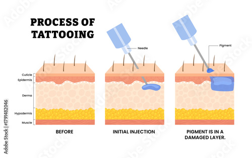 The process of tattooing stage in skin with ink. Labeled before, initial injection penetrates with needle, pigment is in a damaged layer. Human skin layers anatomy cross section. Vector illustration