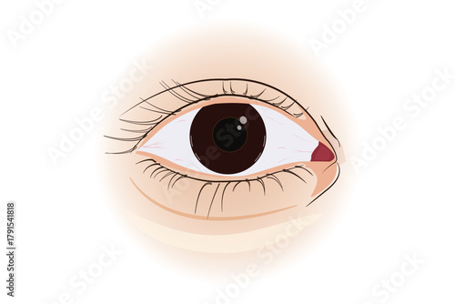 Human eye illustration showing redness or irritation in the inner corner. eps 10