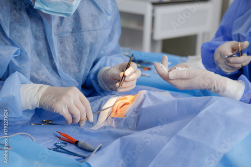Billede på lærred Surgeon suturing upper eyelid during blepharoplasty in a sterile operating room