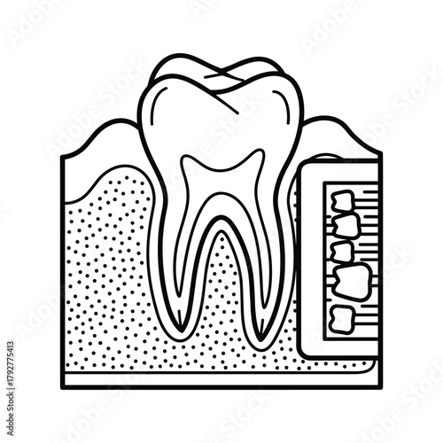 Diagram of a tooth showing roots, pulp, and surrounding bone structure