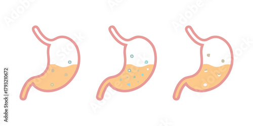 Three diagrams illustrate different stages of digestion within a stomach.