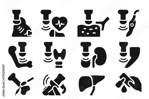 Ultrasound Application Icons. Solid style icons of ultrasound applications: fetal imaging, cardiac echocardiography, abdominal