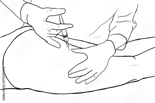 A female person is lying down receiving a body mesotherapy treatment with a syringe in her buttocks, using latex gloves, by a professional.