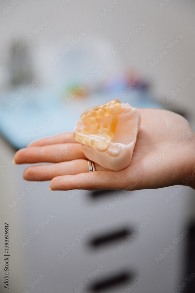 Obraz premium Transparent implant surgical guide on dental jaw model in clinician hand, clinic closeup