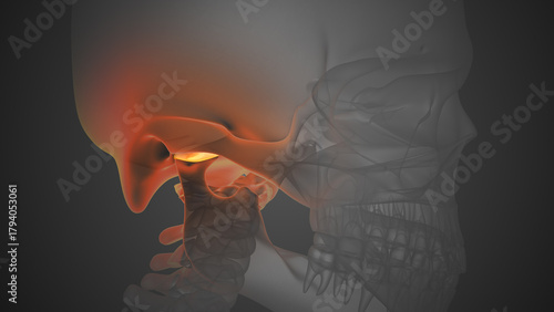 Jaw Joint Inflammation Causing TMJ Disorder Pain