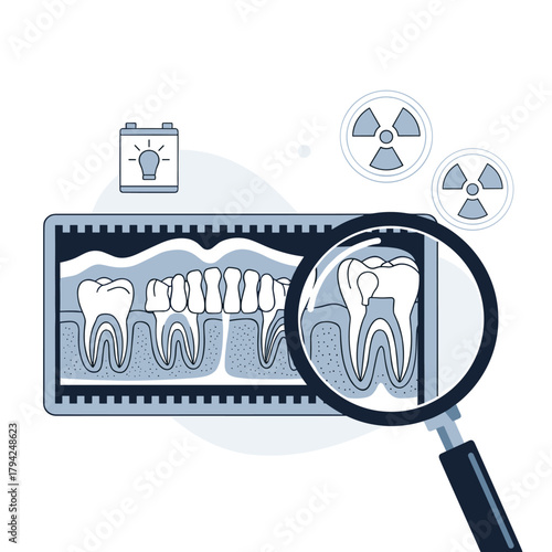 Dental x-ray being examined with a magnifying glass, showing teeth with a filling, roots, and gums for a diagnostic checkup.