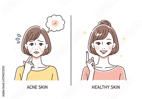 Comparison of a woman with acne skin and a woman with healthy skin, showing a transformation and improvement