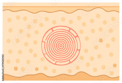 Cross-section of human skin layers with magnified follicle and sebum glands