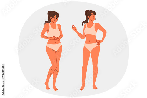 Girl uses depilation and laser hair removal, demonstrating result of visit to cosmetologist. Young woman recommends depilation of legs and face or bikini area using sugaring or hot wax