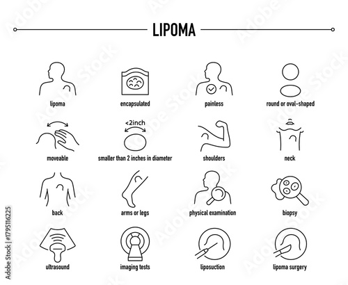 Lipoma symptoms, diagnostic and treatment vector icon set. Line editable medical icons.