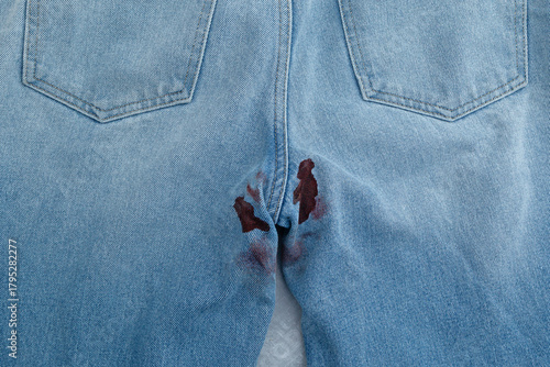 Menstruation or monthly cycle. Blood stain or Period stain on back of jeans, close-up. Aunt Flo is visiting. Crimson tide or Unexpected leak. Menstrual Trouble
