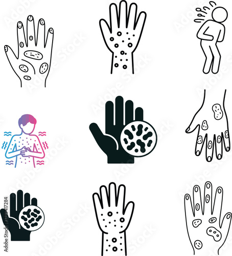 Hand with skin irritation showing symptom of allergi or dermatitis and follicle spots from acne, fungal infection, or psoriasis