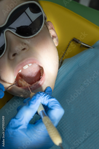 Doctor in blue gloves examines teeth with dental tools, checking molars and gums during oral inspection.