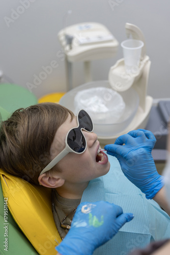 Pediatric dentist applying fluoride or sealant gel to boy’s tooth with small brush.