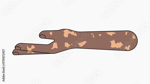 Vitiligo helping hand gesture, flat collage element vector