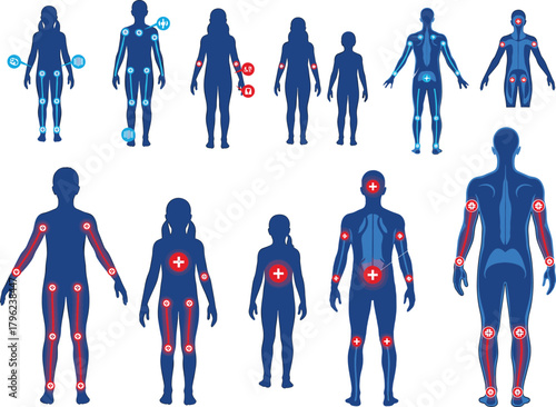 Human body anatomy pain points, medical illustration, muscle and joint diagram, health vector, body map, physiotherapy chart, pain relief zones.