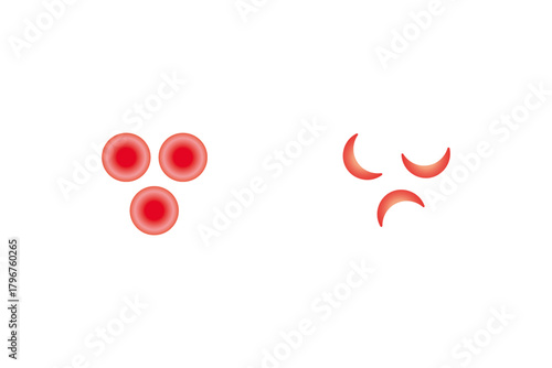 Normal and Sickle Red Blood Cell .Science Design. Vector Illustration.