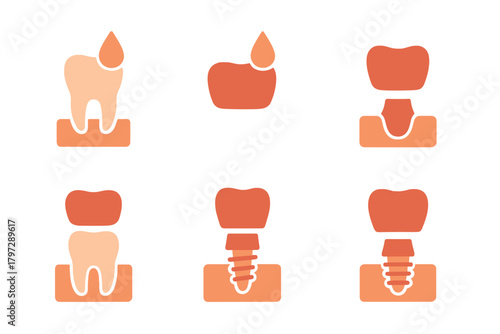 Dental procedures showing tooth decay, crown restoration, and implant surgery steps