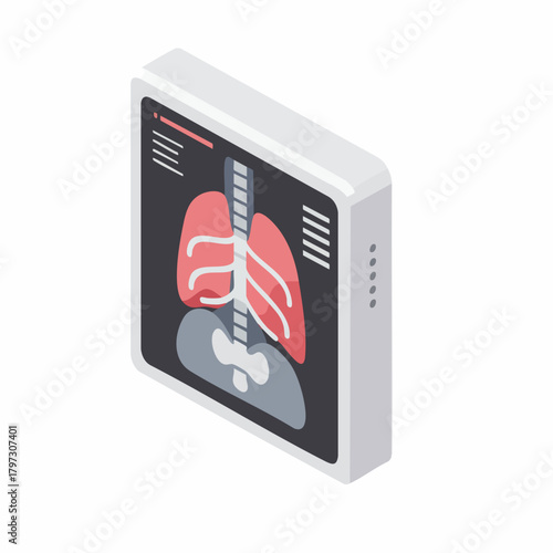 Isometric Detailed Lung X-Ray Scan Result on Monitor Illustration