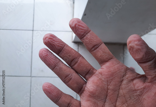 Close-up of wrinkled fingers and palms after long exposure to water, showing detailed skin texture and natural lines. Ideal for themes of skincare, moisture, aging, hygiene, and human anatomy.