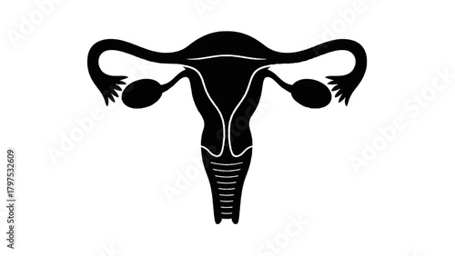 Vector illustration of black silhouette of the female reproductive system on a transparent background