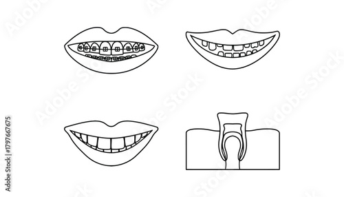 Illustrations of teeth with braces and tooth decay in black and white