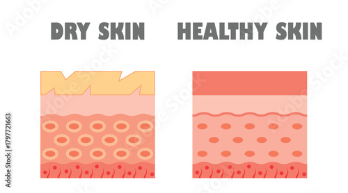Dry Skin vs Healthy Skin: Side-by-Side Skin Care Comparison Showcasing Texture and Hydration