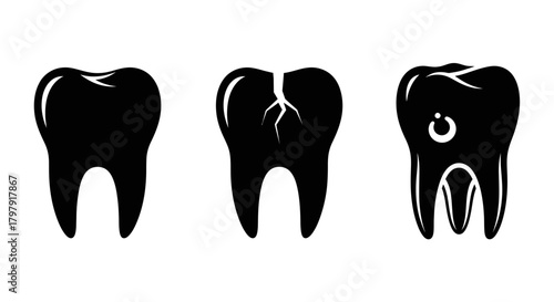 Healthy, cracked, and decayed tooth stages: dental health evolution