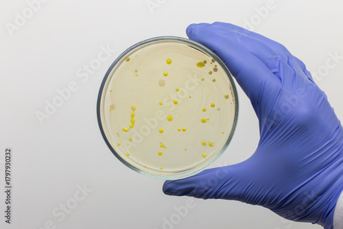 Yellow bacterial colonies on selective agar in a petri dish, close-up of a petri dish held by a scientist on a gray background.