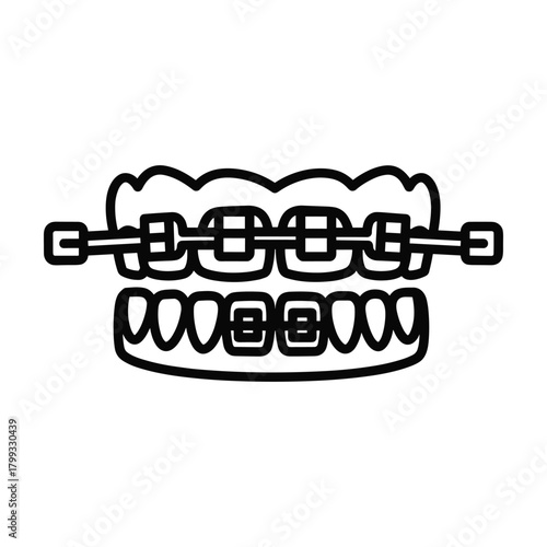 Simple line art illustration of human teeth with metal braces and archwire for orthodontic treatment