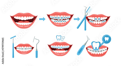 An illustrative guide to orthodontic treatment, from initial braces application to daily care, highlighting tools and tooth health maintenance.