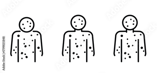 Smallpox. Skin rash, measles, irritation orallergic reaction.. Red rash on the body. food allergy orother autoimmune diseases. Rubeola or morbilli symptom. food allergy. Eczema, variola.