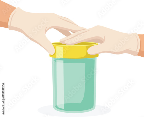 Two gloved hands securely closing a transparent medical sample container with a yellow lid for safe handling