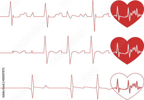 Vector collection of EKG heartbeat lines with red heart icons representing life, health, and cardiology diagnostics for medical design