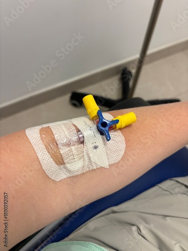 Medical IV Arm With Tape, Bandage, And Clip Attachments In Hospital Room Setting