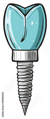 Illustrated dental implant with a blue prosthetic tooth crown and metal screw fixture