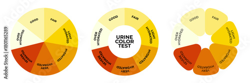 Urine color chart set. Vector design for medical education about hydration and dehydration levels