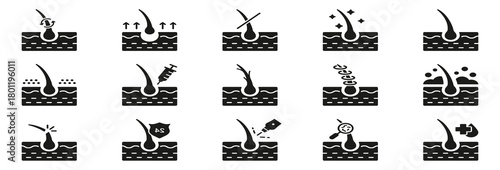 Hair Loss, Growth, Transplant, Removal, Care Silhouette Black Icon Set. Healthy Dermatology Therapy for Epidermis Glyph Pictogram. Hair Follicle Treatment Icon. Isolated Vector Illustration.