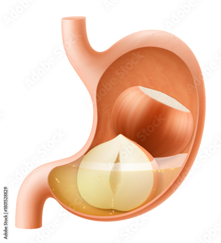 Human Stomach with hazelnuts. The stomach digests hazelnut. A stomach filled with healthy food with protein. Proper nutrition. Realistic 3d Vector illustration. Food digestion process illustration