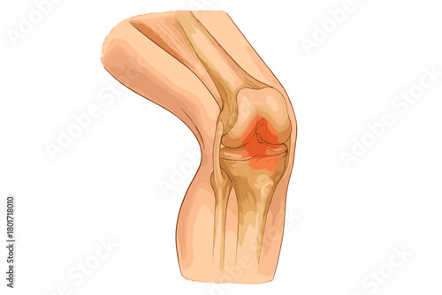 Detailed anatomy of human knee joint structure showing inflammation and pain