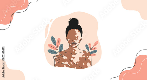 A serene portrait of a young woman with vitiligo embracing self-love and body positivity, surrounded by delicate foliage and soft colors.