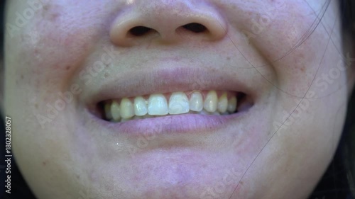 Close up cropped view female mouth unrecognizable woman girl lady Indian Arabian smiling healthy teeth toothy smile laugh whitening dental oral clinic medicine health indoors at home clinic half face