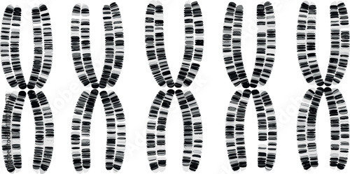 Detailed view of human chromosomes showing banding patterns for genetic analysis.